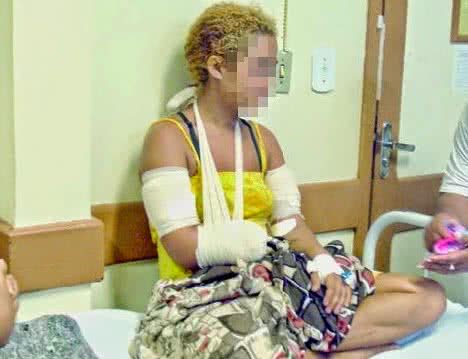 Imagem Mulher chega em hospital segurando a própria mão decepada