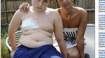 Imagem Jovem de 12 anos tem o peito perfurado por uma lança e sobrevive