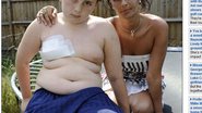 Imagem Jovem de 12 anos tem o peito perfurado por uma lança e sobrevive
