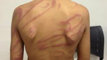 Imagem Pai espanca e tortura filho por ser gay