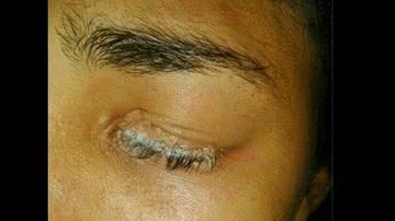 Imagem Mulher cola um dos olhos com super-bonder tentando pôr cílios postiços