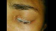 Imagem Mulher cola um dos olhos com super-bonder tentando pôr cílios postiços