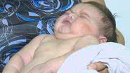 Imagem Menina nasce com mais de 5kg e do tamanho de bebê de três meses