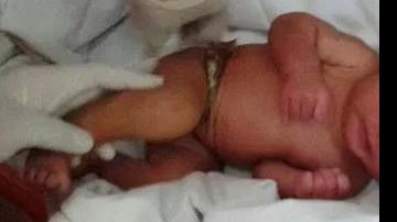 Imagem   Com cordão umbilical, bebê é achada em caixa de papelão  