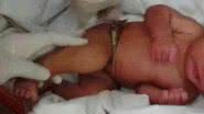 Imagem   Com cordão umbilical, bebê é achada em caixa de papelão  
