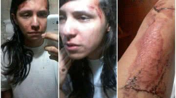 Imagem  Jovem gay diz em rede social ter sido espancado por 3 homens