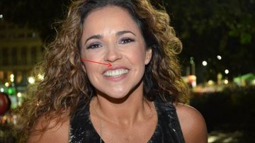 Imagem Daniela Mercury mostra marca do soco