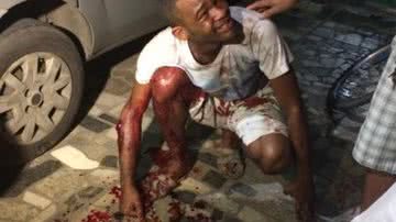 Imagem Homem acusado de estupro leva pauladas e facada em Águas Claras
