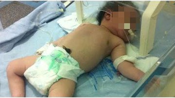 Imagem Isaias conseguiu: após denúncia do Bocão, bebê que luta pela vida é transferido