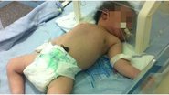 Imagem Famigerada Saúde Pública: bebê em estado grave luta pela vida na fila de espera
