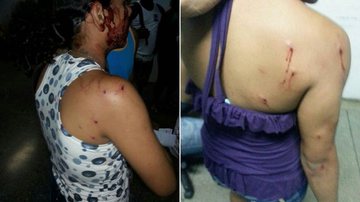 Imagem Mulheres são atingidas por estilhaços de escopeta no Beirú