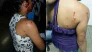 Imagem Mulheres são atingidas por estilhaços de escopeta no Beirú