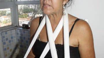 Imagem Professora que sofreu acidente vai processar Colégio Resgate 