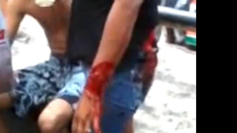 Imagem Mulher é retalhada por companheiro após traição