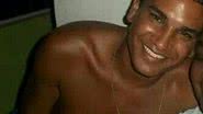 Imagem Morre homem que teve 90% do corpo queimado pelo ex da mulher