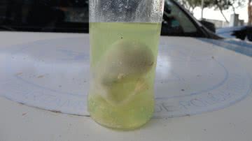 Imagem Feto é encontrado dentro de pote em via pública