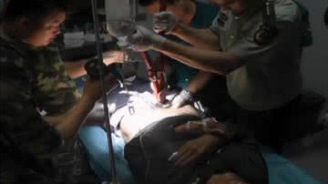 Imagem Com anel preso no pênis, idoso é socorrido por médicos e bombeiros