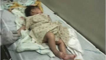 Imagem Iguaí: bebê com sinais de maus tratos morre em hospital