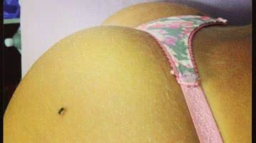 Imagem Mosquito 'chupa' bumbum de Andressa Urach