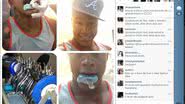 Imagem Léo Santana se livra de aparelho nos dentes