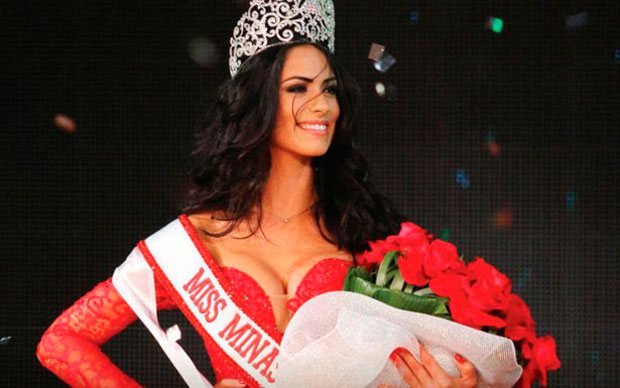 Imagem Vice Miss Brasil é diagnosticada com doença que causa cegueira