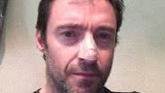 Imagem Ator de "Wolverine" está tratando um câncer