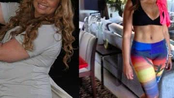 Imagem Solange Almeida posta foto de antes e depois de redução de estômago