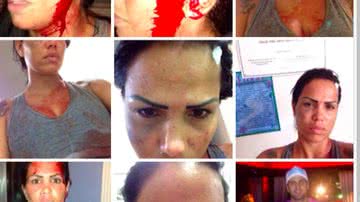 Imagem MC Sexy apanha do namorado e posta fotos na internet