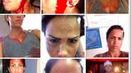 Imagem MC Sexy apanha do namorado e posta fotos na internet