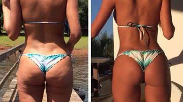 Imagem Fotos: ex-BBB mostra antes e depois de bumbum