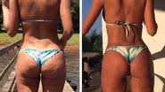 Imagem Fotos: ex-BBB mostra antes e depois de bumbum
