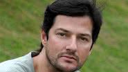 Imagem Marcelo Serrado tem lesão no pinto após sexo selvagem, diz colunista