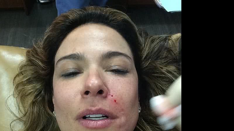 Imagem Luciana Gimenez faz tratamento com sangue. Assista