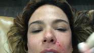Imagem Luciana Gimenez faz tratamento com sangue. Assista