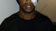 Imagem Ronaldinho publica foto com tampão no olho