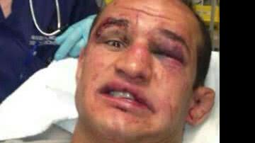Imagem Com o rosto amassado, Cigano brinca em hospital