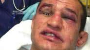 Imagem Com o rosto amassado, Cigano brinca em hospital