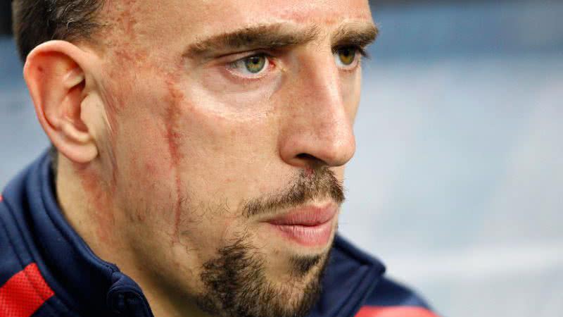Imagem Bomba! Astro da França, Ribery está fora da Copa do Mundo