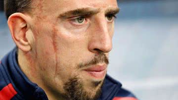 Imagem Bomba! Astro da França, Ribery está fora da Copa do Mundo