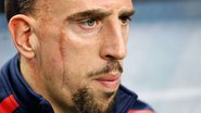 Imagem Bomba! Astro da França, Ribery está fora da Copa do Mundo