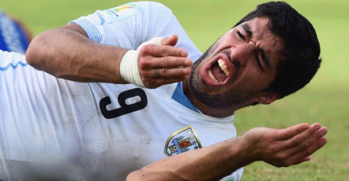 Imagem "Mordido", Uruguai enfrenta a Colômbia sem Suarez neste sábado 