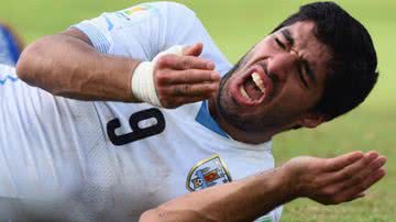 Imagem "Mordido", Uruguai enfrenta a Colômbia sem Suarez neste sábado 