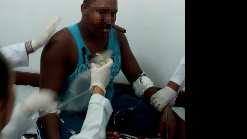 Imagem Homem dá entrada em UPA com faca cravada no rosto