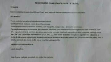 Bocão News