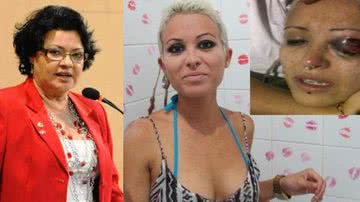 Imagem Luiza Maia quer punição para o segurança do teatro Acbeu