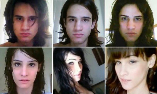 Imagem Transexual mostra em vídeo mudanças após cirurgias no rosto
