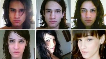 Imagem Transexual mostra em vídeo mudanças após cirurgias no rosto