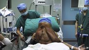Imagem “Homem elefante” retira tumor de 15 quilos do rosto