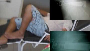 Imagem Caminhoneiro acorda com lanterna no ânus e alega ter sido dopado