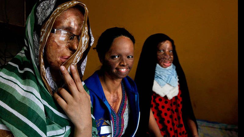 Imagem Após frequentes ataques às mulheres, Índia restringe venda de ácido
